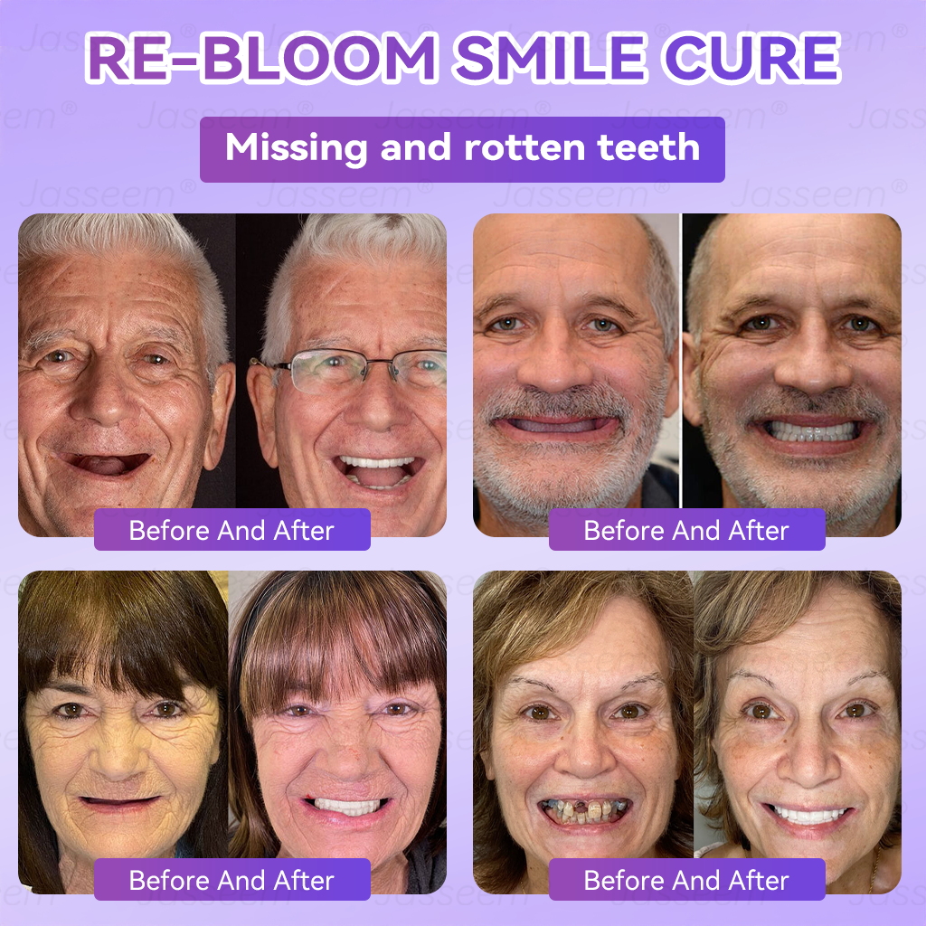 𝐉𝐚𝐬𝐬𝐞𝐞𝐦® Latest Premium Comfort Dentures💧 (High-End Dentures, Easy to Wear - Limited Time 70% Off)🔥