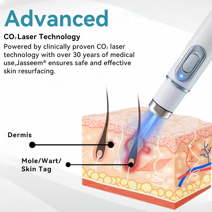 𝐉𝐚𝐬𝐬𝐞𝐞𝐦® Medical-Grade Laser Pen 🔥 (Powered by CO₂ laser technology – effectively removes moles, warts, skin tags, pigmentation marks, and other skin imperfections)🏆