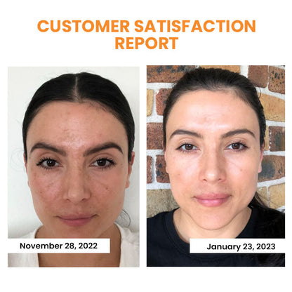 (🔥LAST DAY 70% OFF 🔥) Korean Technology Soluble Collagen Film